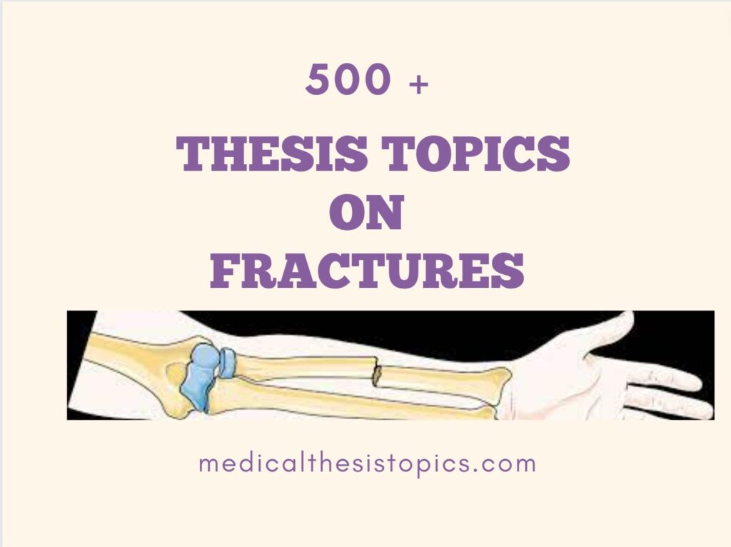 fractures thesis topics