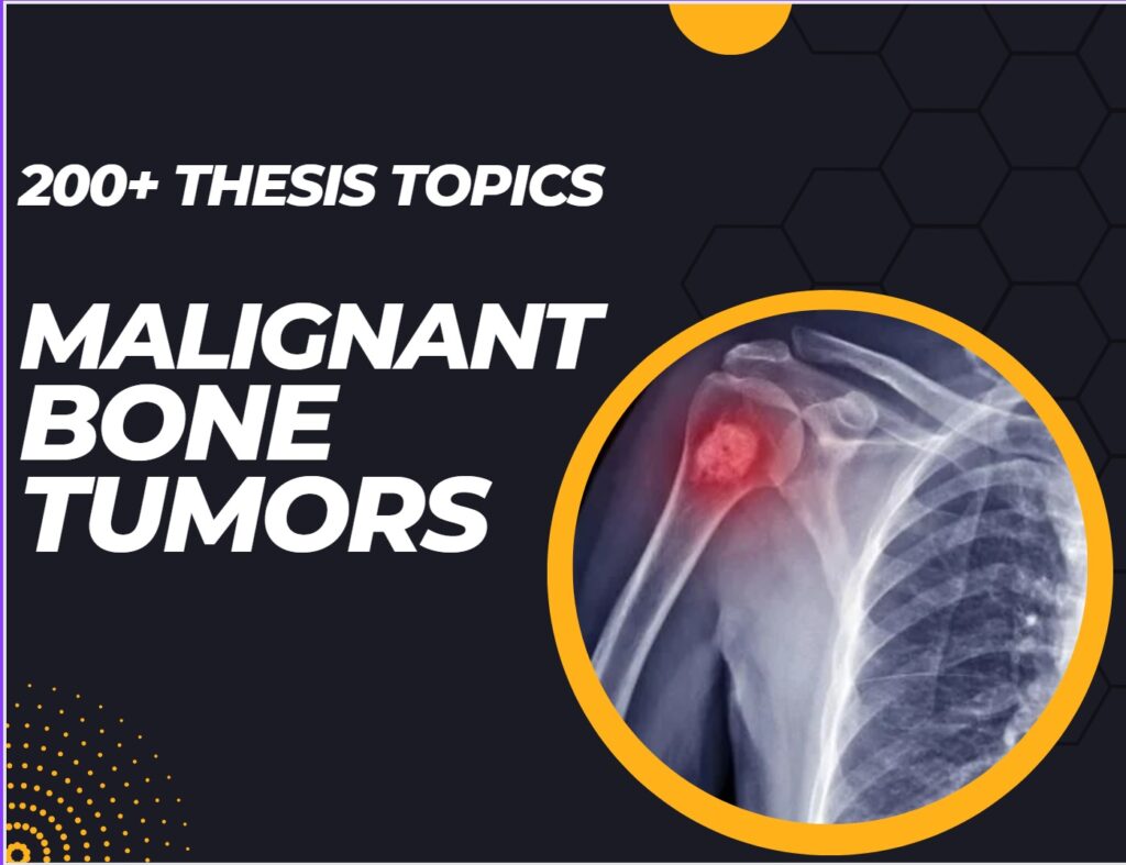 Malignant Bone Tumors thesis Topics