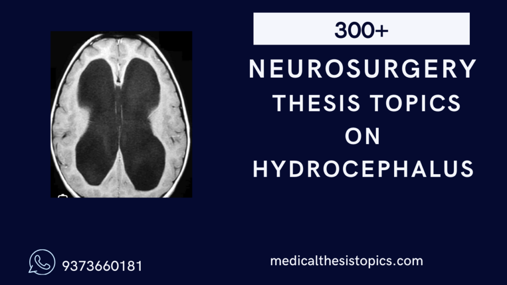 hydrocephalus neurosurgery thesis topics